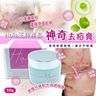 Hoia Acne Cream 50g【Genuine Product】EXP. 2025/11｜Deer By Deer