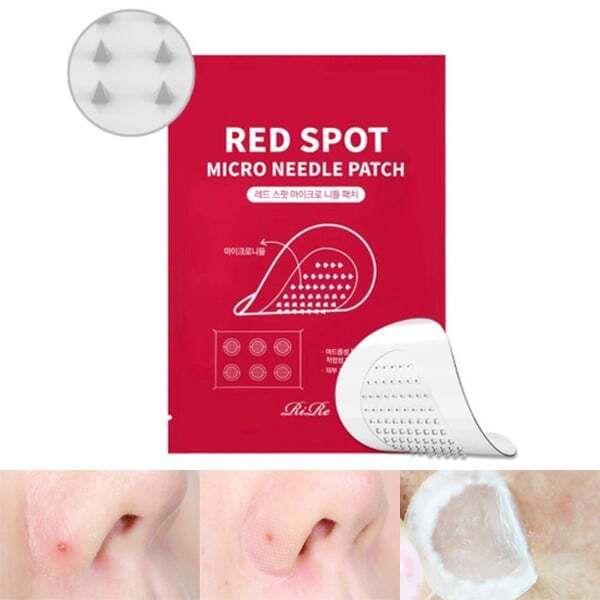 微針暗瘡貼 6pcs