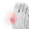 Pressure Protection For the Ball Of Foot (pedag Hallux Pad) (x1 pc: suitable for both side)
