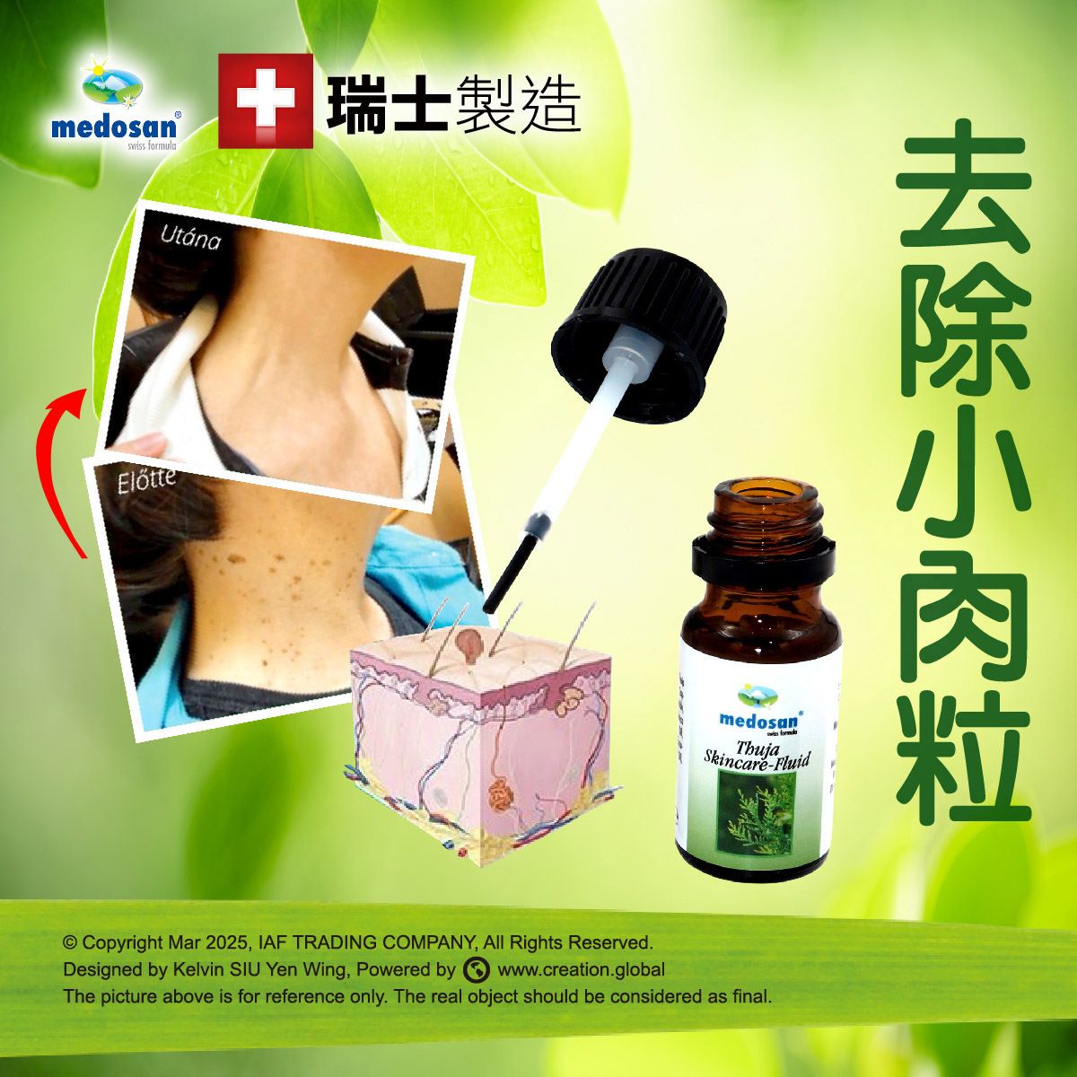 植物除疣肉粒精華  去油脂粒/小肉粒/去角質