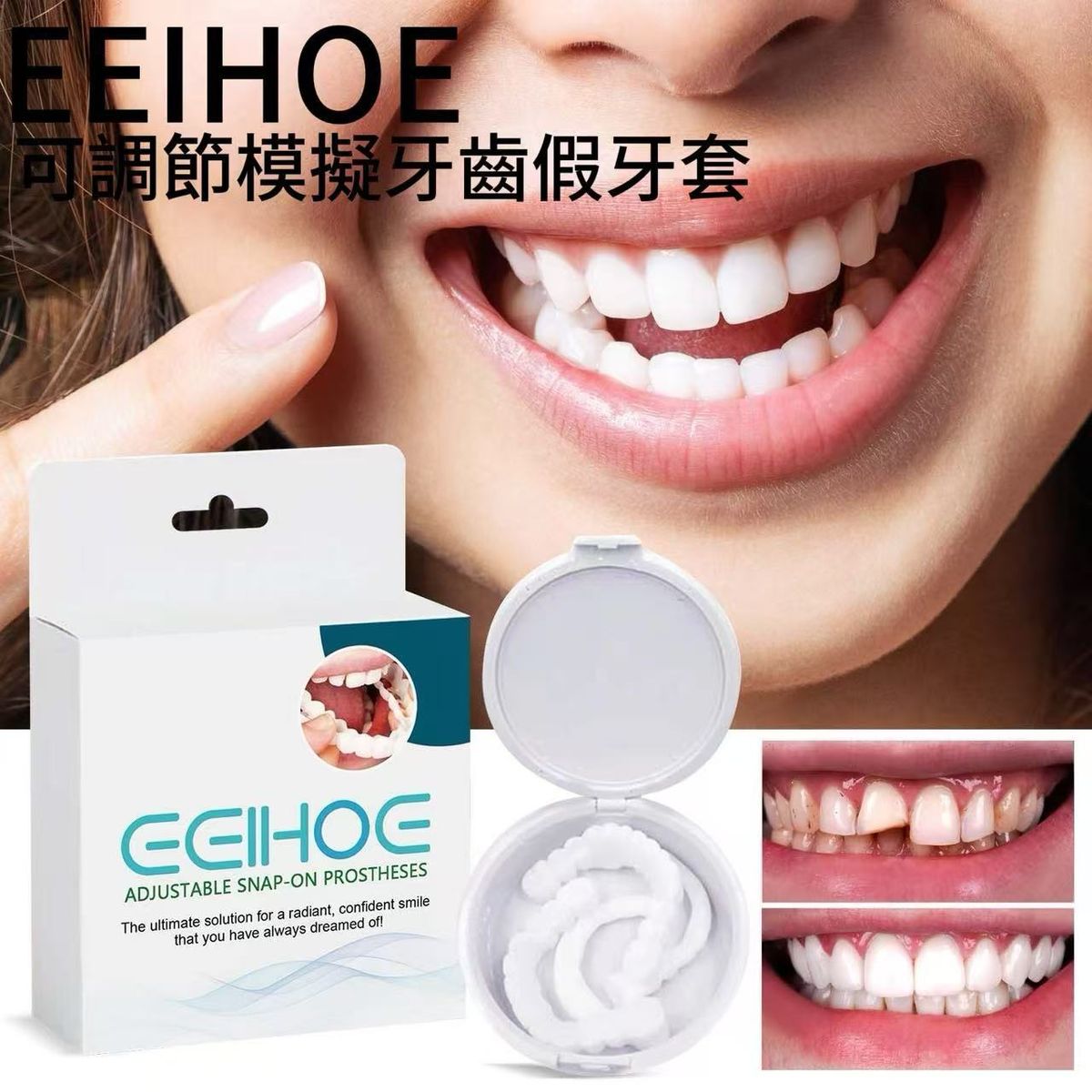 EELHOE 可調節模擬牙齒假牙套 牙縫補齊牙套 老人模擬牙套 修飾斷牙齒牙套  假牙牙齒套裝 丨牙齒護理 護理用品《一對裝》