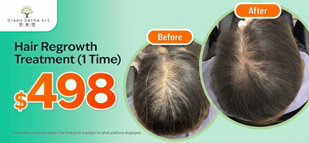 deals_regular_offer_slidera_hair regrowth_202607015